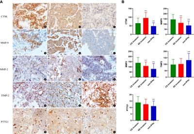 Expression and clinical significance of Cathepsin K and MMPs in invasive non-functioning pituitary adenomas